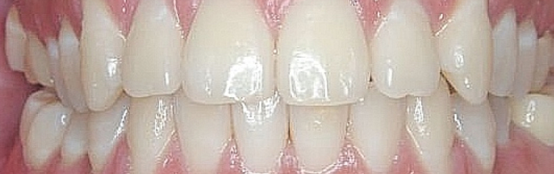 b01